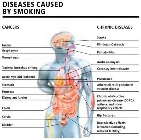 How likely is it to get lung cancer after one year of smoking?