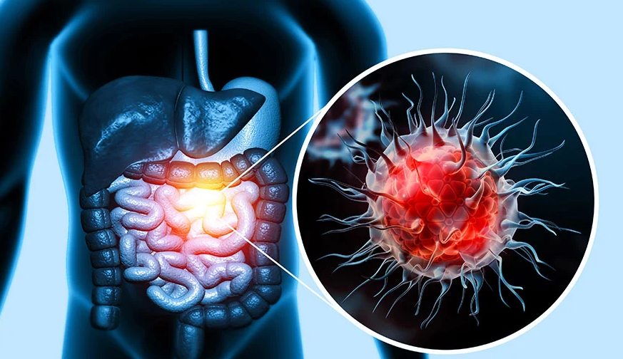 A Real Look at Treatment, Outcomes and Challenges