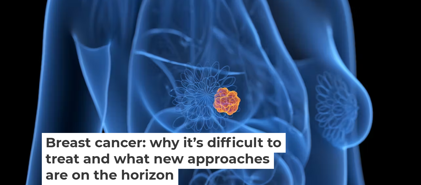 Understanding Breast Cancer: Challenges, Tumour Types, and the Promise of Precision Medicine