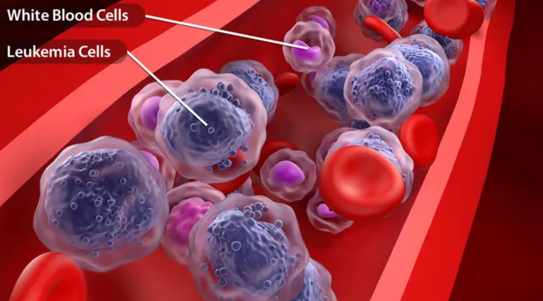 Experts urge Nigerians to embrace early screening, HPV vaccine